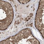 MAPKBP1 Antibody in Immunohistochemistry (Paraffin) (IHC (P))