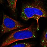 Glypican 4 Polyclonal Antibody