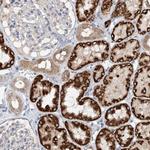 Glypican 4 Antibody in Immunohistochemistry (IHC)