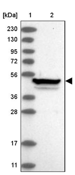 ZNF774 Antibody in Western Blot (WB)