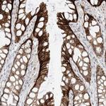 ZNF774 Polyclonal Antibody