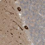 CNKSR1 Antibody in Immunohistochemistry (Paraffin) (IHC (P))