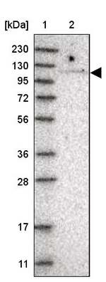 TBC1D2 Antibody in Western Blot (WB)