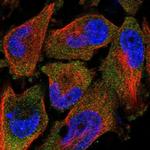 TAL2 Antibody in Immunocytochemistry (ICC/IF)