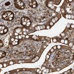 ZNF358 Antibody in Immunohistochemistry (IHC)