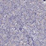 NCAM2 Polyclonal Antibody