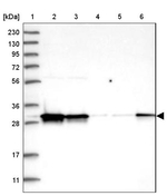 SARNP Antibody in Western Blot (WB)