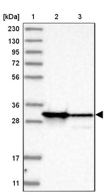 SARNP Antibody in Western Blot (WB)