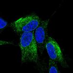 ZNF354C Polyclonal Antibody