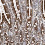 ZNF354C Antibody in Immunohistochemistry (Paraffin) (IHC (P))