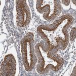 ZNF354C Antibody in Immunohistochemistry (Paraffin) (IHC (P))