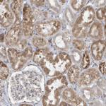 ZNF354C Antibody in Immunohistochemistry (Paraffin) (IHC (P))
