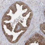 ZNF354C Antibody in Immunohistochemistry (Paraffin) (IHC (P))