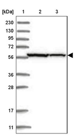 ZNF354C Antibody in Western Blot (WB)