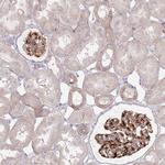 ZNF843 Polyclonal Antibody