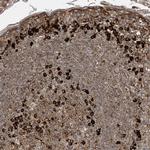 MX1 Antibody in Immunohistochemistry (IHC)