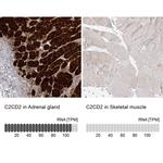 C2CD2 Polyclonal Antibody