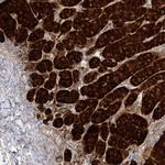 C2CD2 Antibody in Immunohistochemistry (IHC)