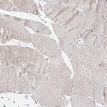 C2CD2 Antibody in Immunohistochemistry (IHC)