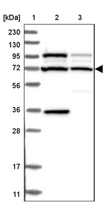C2CD2 Antibody in Western Blot (WB)