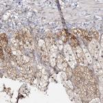 C2CD2 Antibody in Immunohistochemistry (Paraffin) (IHC (P))