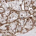 C2CD2 Antibody in Immunohistochemistry (Paraffin) (IHC (P))