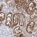 SH3YL1 Polyclonal Antibody