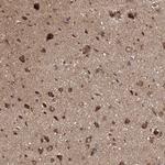 BRWD1 Polyclonal Antibody