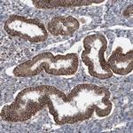 BRWD1 Polyclonal Antibody