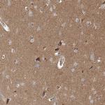 BRWD1 Antibody in Immunohistochemistry (IHC)
