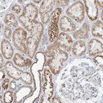 BDH1 Antibody in Immunohistochemistry (Paraffin) (IHC (P))