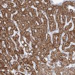BDH1 Antibody in Immunohistochemistry (Paraffin) (IHC (P))
