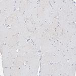 BDH1 Antibody in Immunohistochemistry (Paraffin) (IHC (P))