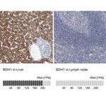 BDH1 Antibody in Immunohistochemistry (IHC)