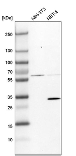 BDH1 Antibody in Western Blot (WB)