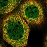 AIM1 Polyclonal Antibody