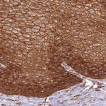 AIM1 Antibody in Immunohistochemistry (Paraffin) (IHC (P))