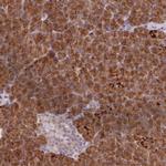 AIM1 Polyclonal Antibody