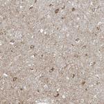 FNDC1 Antibody in Immunohistochemistry (Paraffin) (IHC (P))