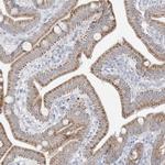 FNDC1 Antibody in Immunohistochemistry (Paraffin) (IHC (P))
