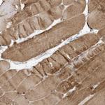 FNDC1 Antibody in Immunohistochemistry (Paraffin) (IHC (P))