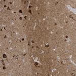 FNDC1 Antibody in Immunohistochemistry (IHC)