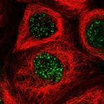 FNDC1 Polyclonal Antibody