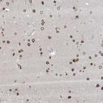 FNDC1 Antibody in Immunohistochemistry (Paraffin) (IHC (P))