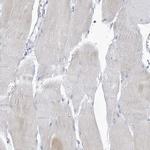 VTA1 Polyclonal Antibody