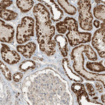 N4BP3 Antibody in Immunohistochemistry (Paraffin) (IHC (P))