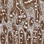 N4BP3 Antibody in Immunohistochemistry (Paraffin) (IHC (P))