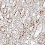 N4BP3 Polyclonal Antibody