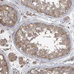 AGBL5 Antibody in Immunohistochemistry (Paraffin) (IHC (P))