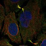 AGBL5 Polyclonal Antibody